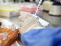 Supercharging Immune Cells May Help Control HIV Long-Term