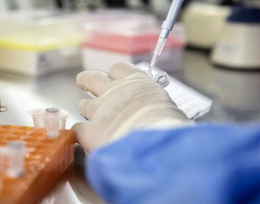 Supercharging Immune Cells May Help Control HIV Long-Term
