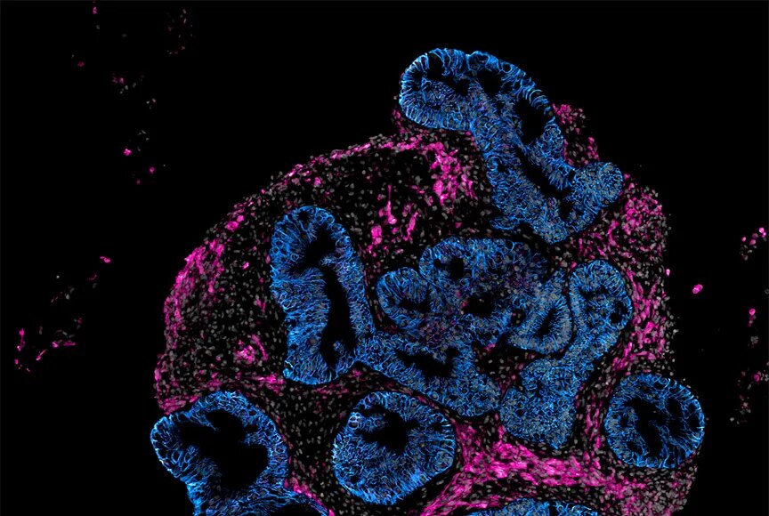 2DOrganoidSlice_greynuclei_pinksmoothmuslce_blueepithelium_INTEROBIO.jpg