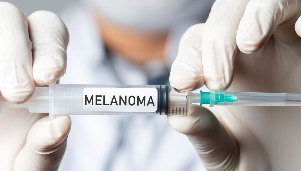 vacuna20melanoma202275195271.jpg